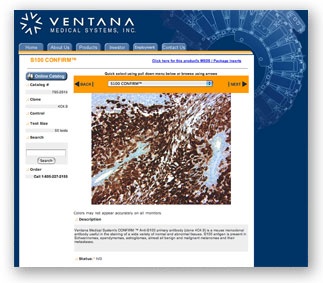 Ventana Medical Ventana Medical